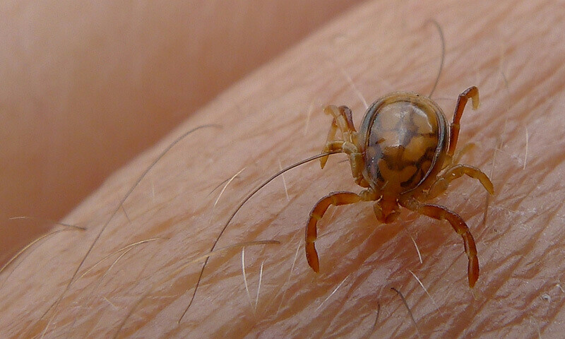 First Congo Virus Death Reported in Sindh as Healt